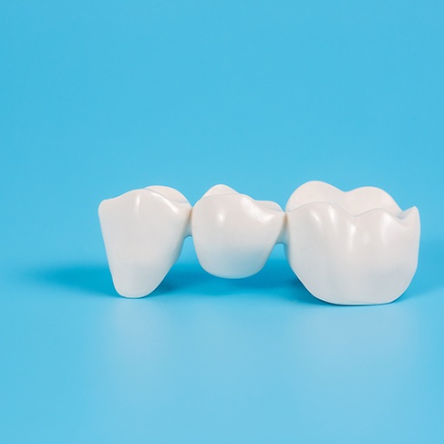 Single dental bridge in Louisville on blue surface