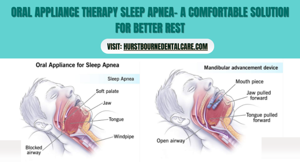 Oral Appliance Therapy Sleep Apnea